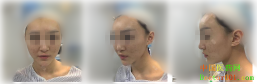 ͼƬ1.png