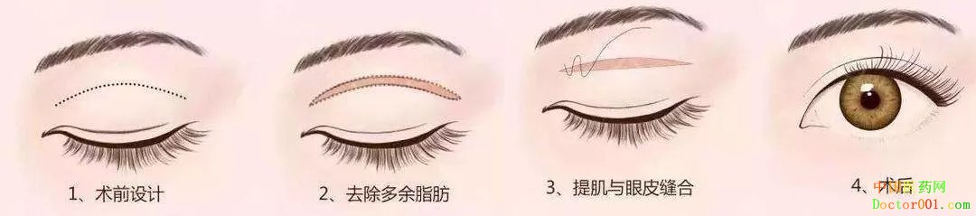 640.webp (2).jpg