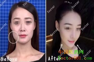QQͼ20181123170231.png