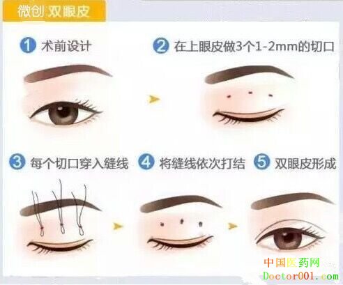 QQͼƬ20170721132627.jpg