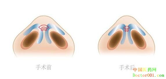 1552446013666340.jpg 307-160ZQQ441234.jpg