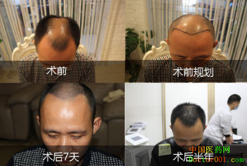 QQͼ20190413170601.png