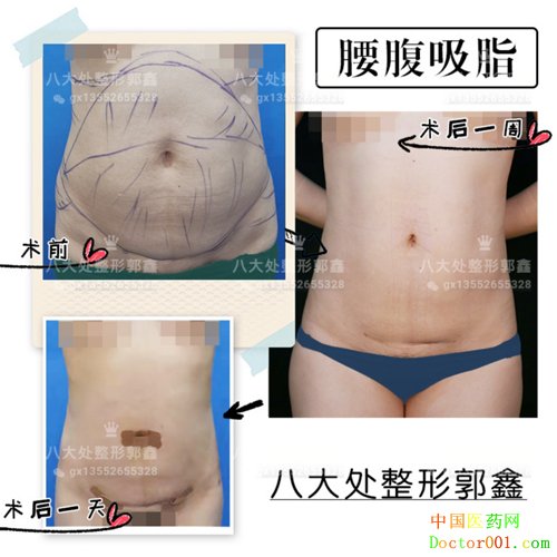 a4bf80f6gy1g6pmi2dpeaj20j61eu777.jpg
