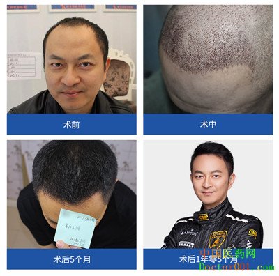 QQͼƬ20190118111217_.jpg
