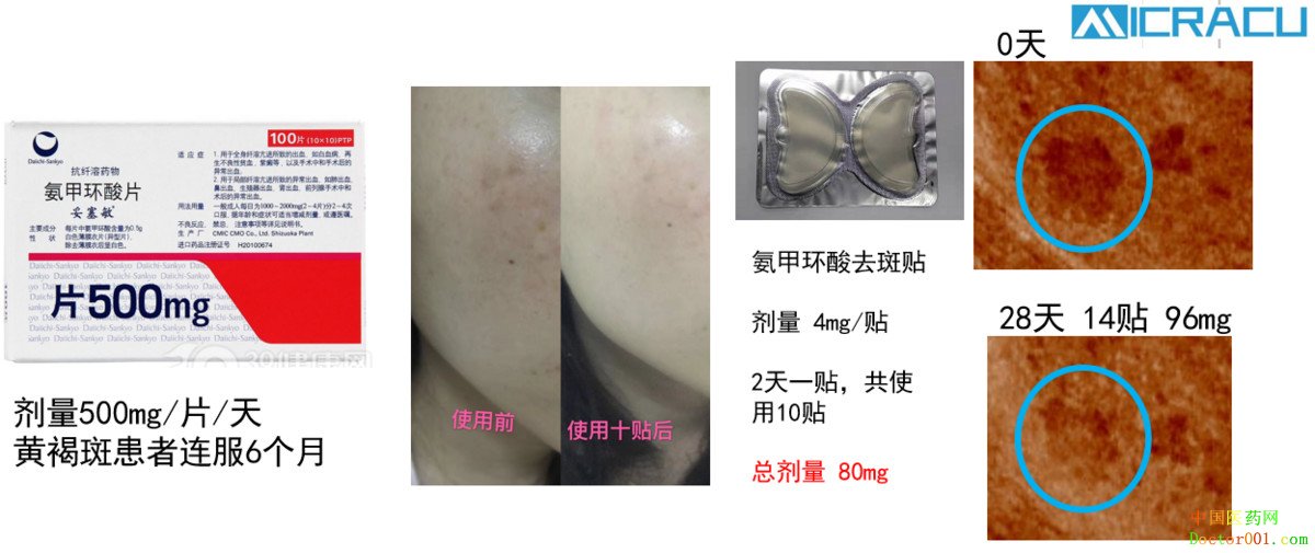 ͸Ƥҩҩƣп΢롹ʵ΢ģ